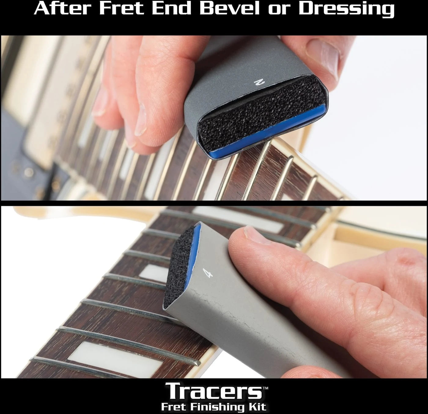 MN871 Fret Sprout Kit