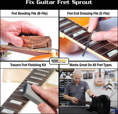 MN871 Fret Sprout Kit